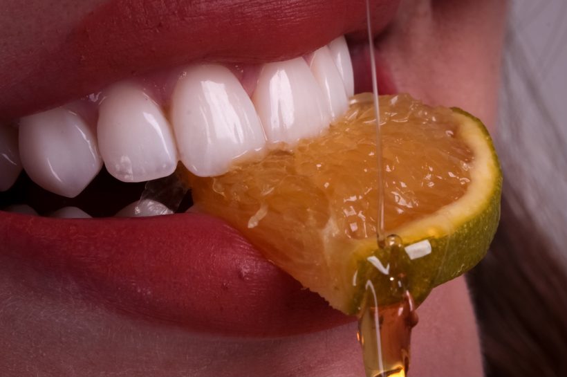 Clareamento dental, dentista em Hortolândia